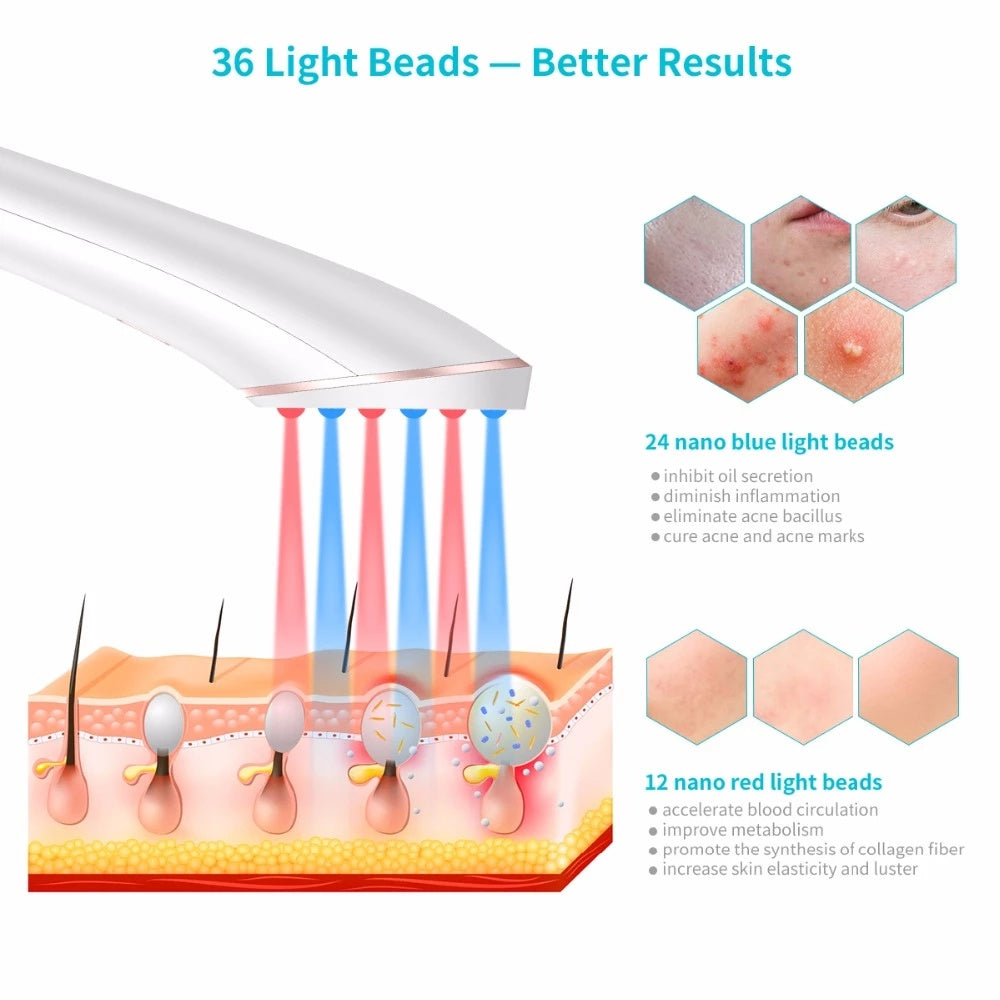 Xpreen Wireless Rechargeable Acne Light Therapy Device โ Blue & Red Light Acne Treatment for Clearer, Healthier Skin